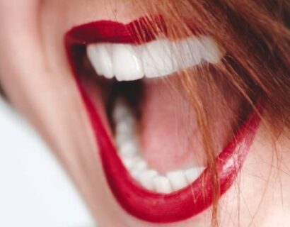Teeth-Cleaning-Polishing Panchkula Vashishth Dental Clinic