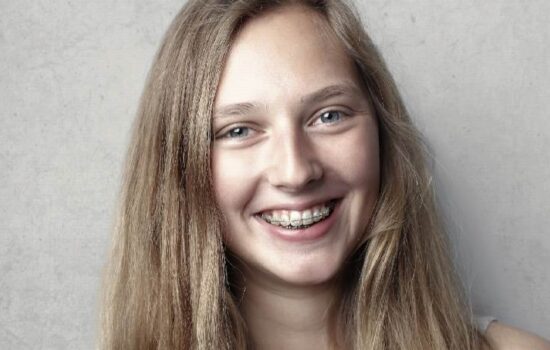 Adult Orthodontics-Braces Panchkula Vashishth Dental Clinic