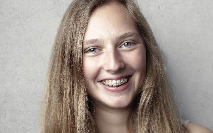 Adult Orthodontics-Braces Panchkula Vashishth Dental Clinic